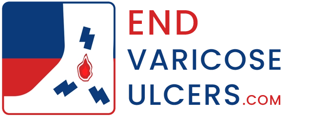 End Varicose Ulcers