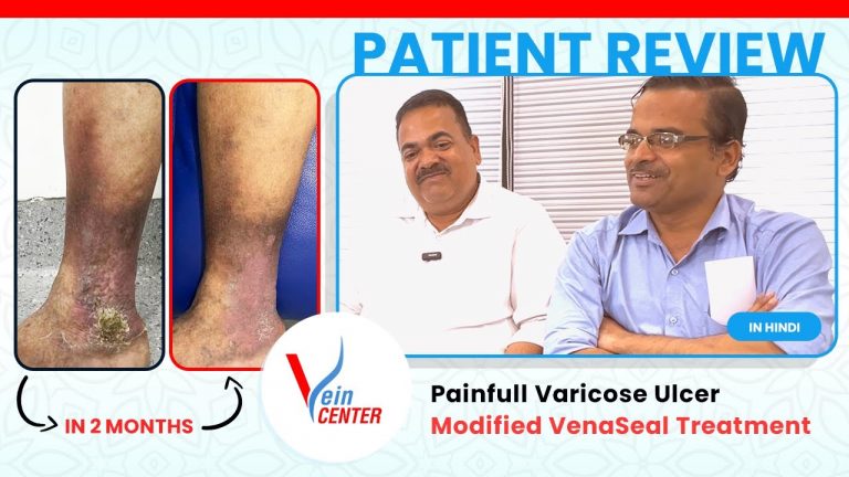 Patient Review by a Professor with Large Venous Ulcer