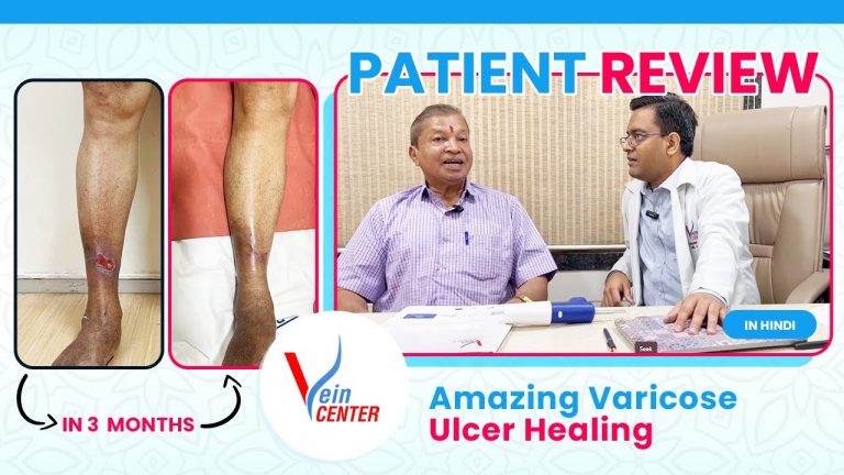 Patient Review in Marathi after Venous Ulcer Treatment