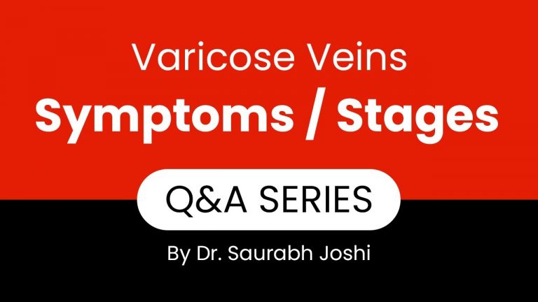 Q&A Series Episode 2 - What are the Symptoms or Stages Varicose Veins