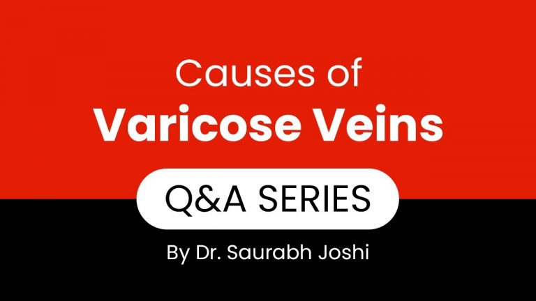 What are the causes of Varicose Veins